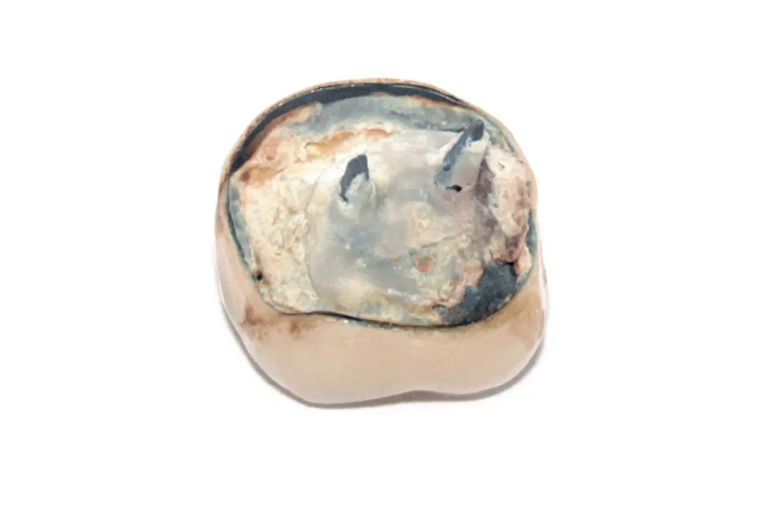 Detached-dental-crown-angle-inner