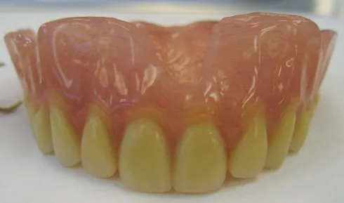 Mr M's Complete Denture2