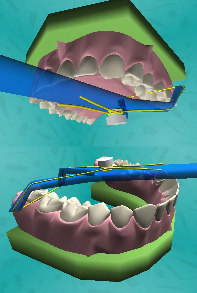 Dental floss upper lower
